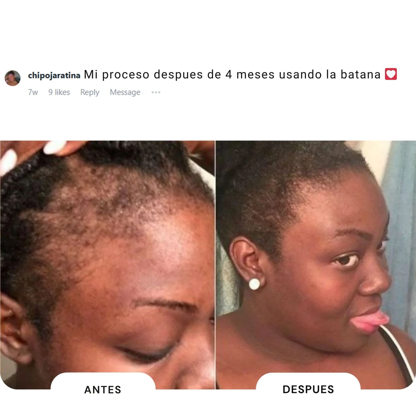 Aceite capilar natural de Batana🌱