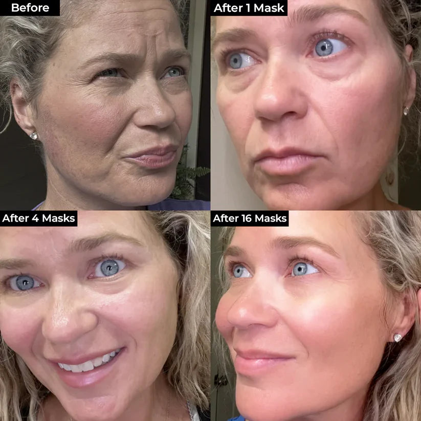 BoxBox™ Mascarilla de Bio-Colágeno || Piel Visiblemente Más Joven