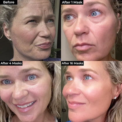 BoxBox™ Mascarilla de Bio-Colágeno || Piel Visiblemente Más Joven