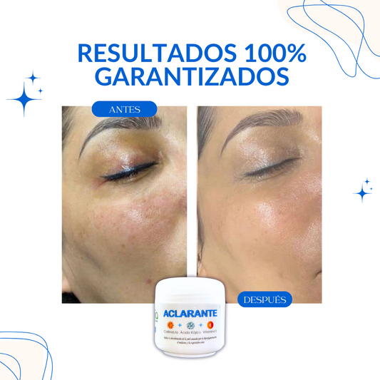 SAAM™ || CUIDADO FACIAL PARA UNA PIEL IMPECABLE + CREMA ANTI ESTRIAS DE REGALO🎁