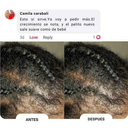 Aceite capilar natural de Batana🌱