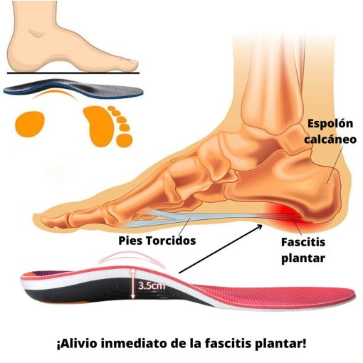Plantillas ortopédicas BOXBOX - Alivia el dolor de pies (2 PARES)