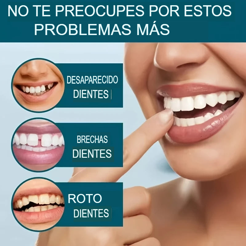 Carillas dentales EverSmile™ Renueva tu Sonrisa sin Visitar al Dentista🦷