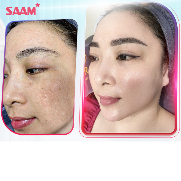 SAAM™ || CUIDADO FACIAL PARA UNA PIEL IMPECABLE + CREMA ANTI ESTRIAS DE REGALO🎁