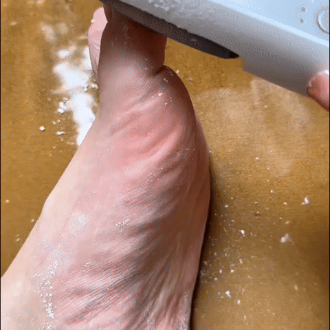 SoftTouch™  Eliminador De Callos