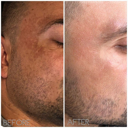 SAAM™ || CUIDADO FACIAL PARA UNA PIEL IMPECABLE + CREMA ANTI ESTRIAS DE REGALO🎁