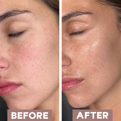 BoxBox™ Mascarilla de Bio-Colágeno || Piel Visiblemente Más Joven